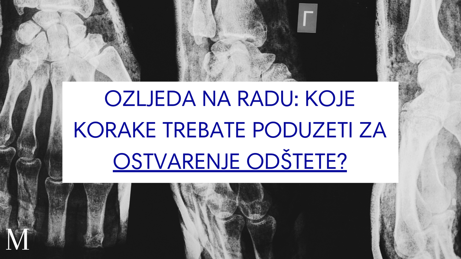 ozljeda na radu odšteta